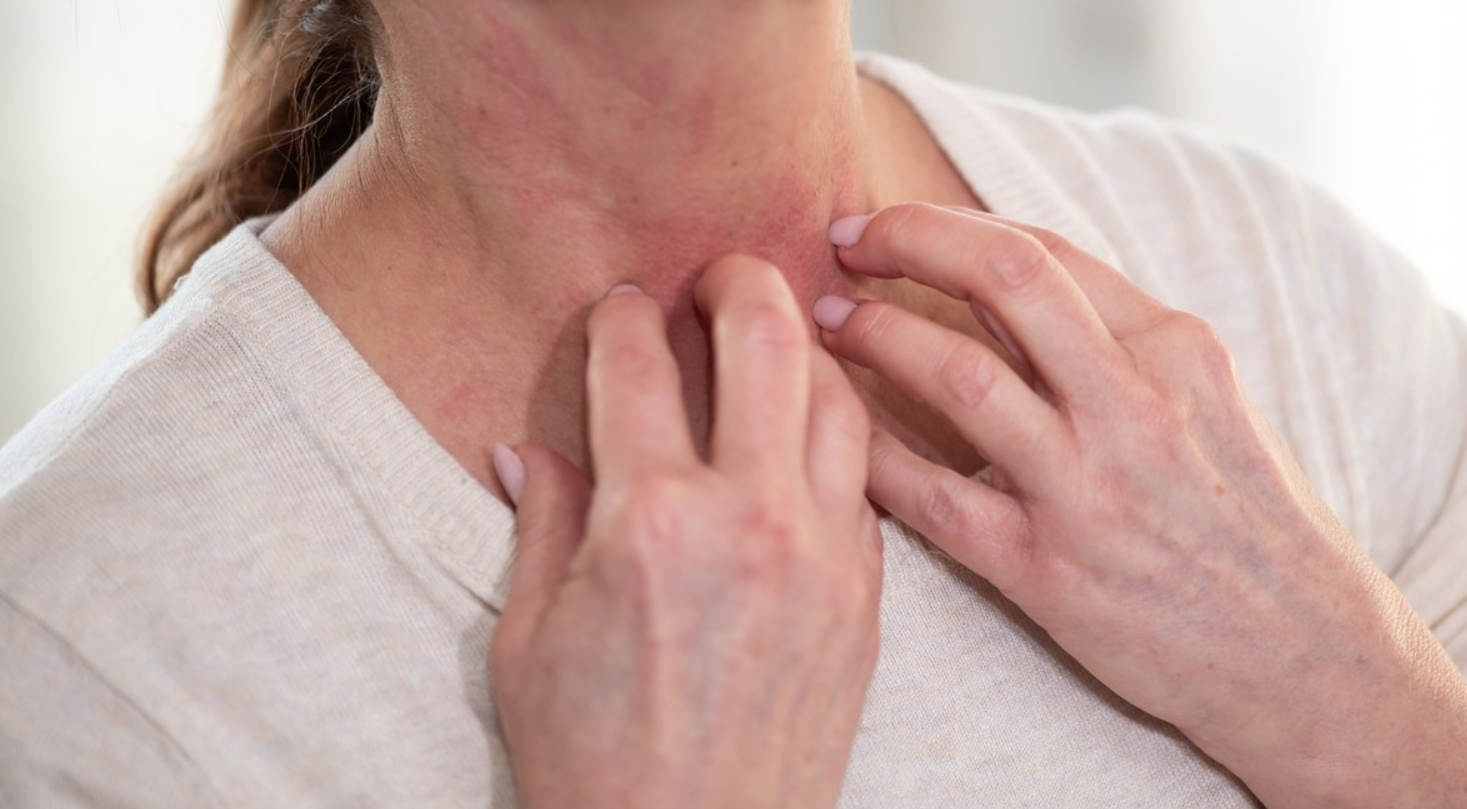 objawy-skórne-przy-niedoborze-witaminy-B