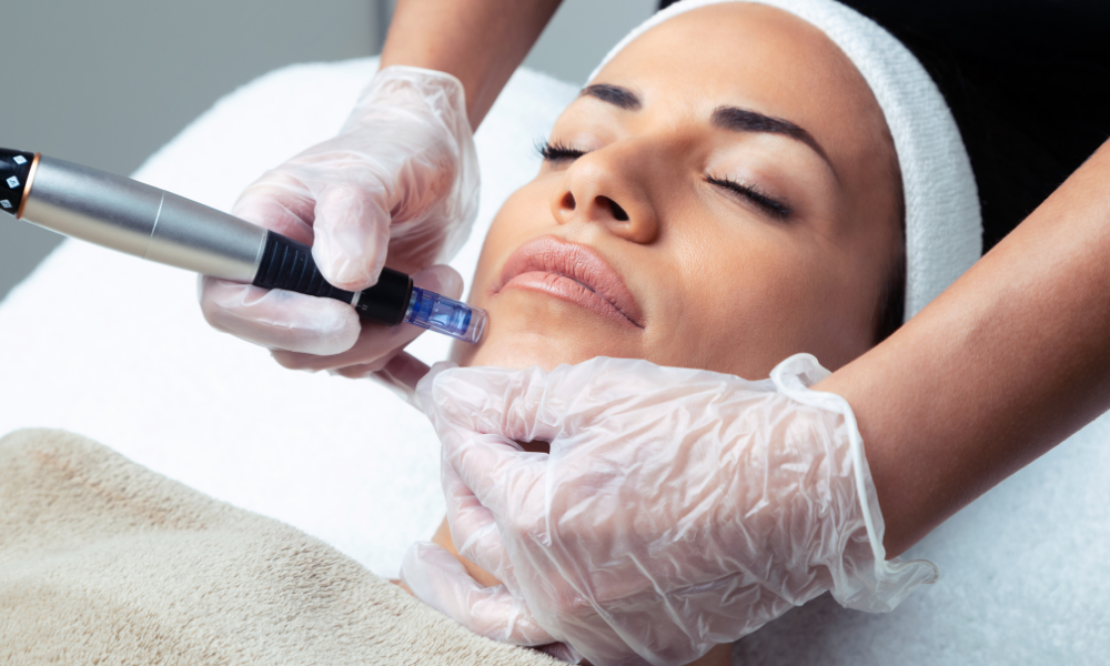 zabieg-mikronakłuwania