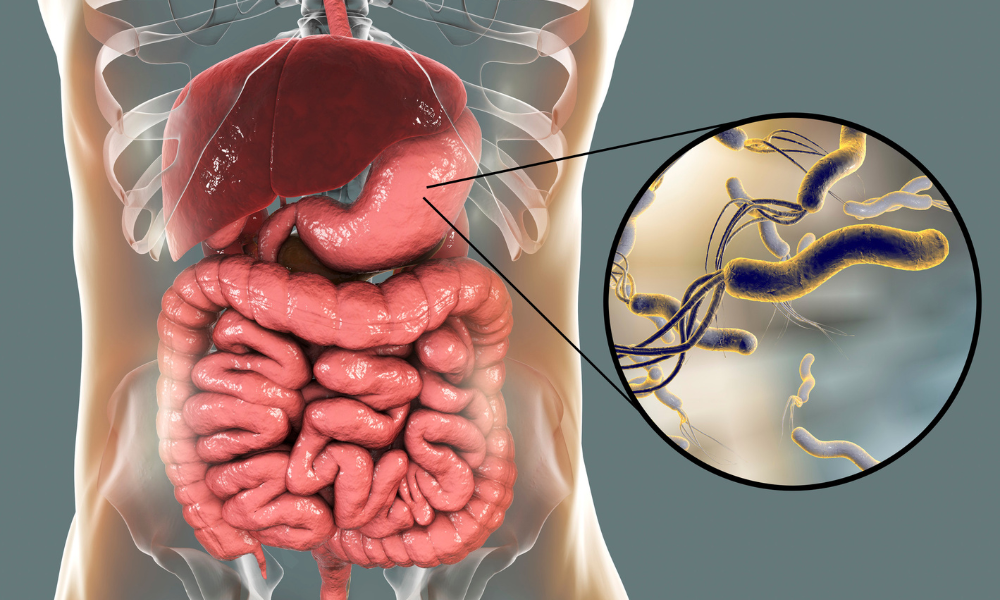 helicobacter-pylori-w-żołądku