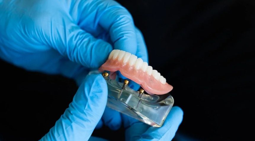 stosowanie-protezy-zębowej