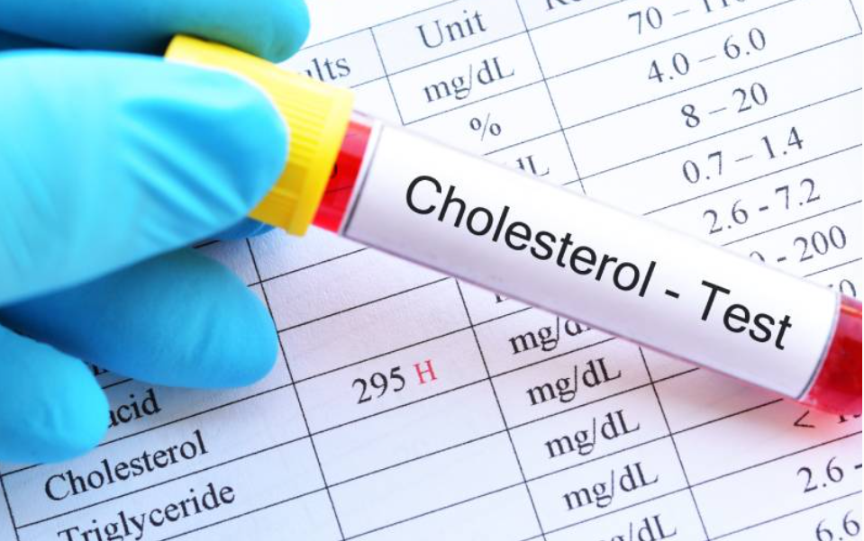 badanie-cholesterolu