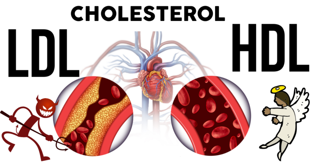 skutki-wysokiego-cholesterolu